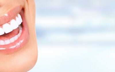 Why Teeth Whitening is Done at the Dentist