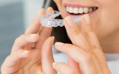 How to Keep Your Invisalign Aligners Clean: Dos and Don’ts from Collingwood Experts