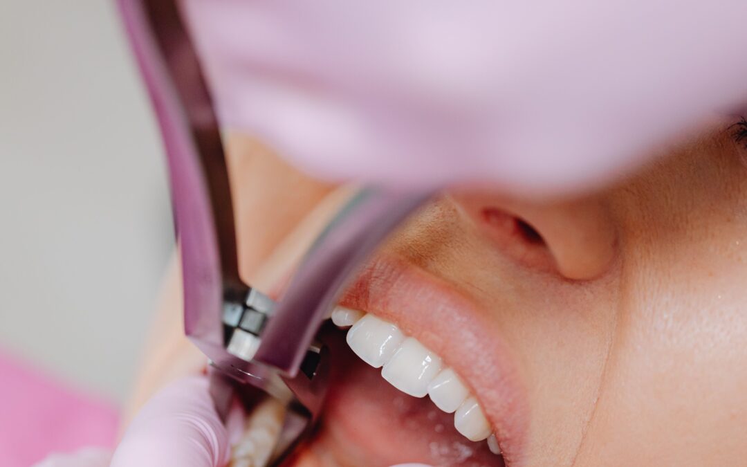 Emergency Dentist Collingwood